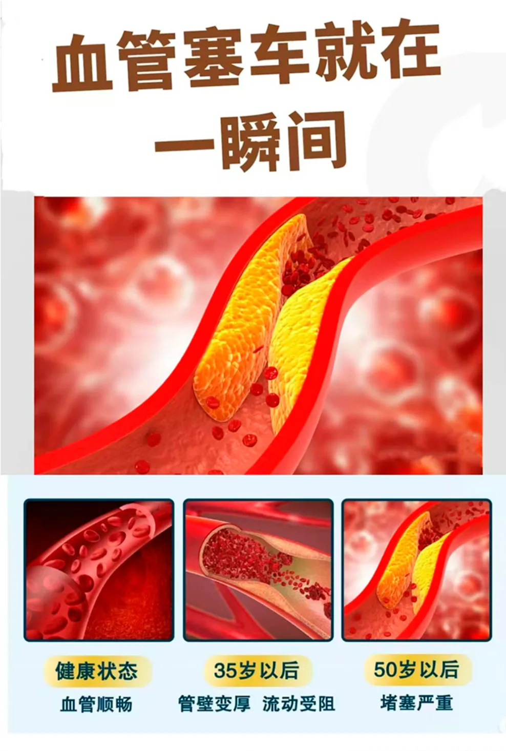 GO Healthy 高之源 胆固醇调节 100粒【保质期2029.02】 详情图 2